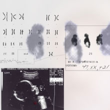 digital print "Amniocentesis-Sonogram I"